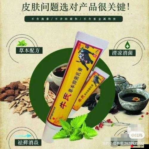 翁止熄痒最简单处理方法：直接涂抹缓解